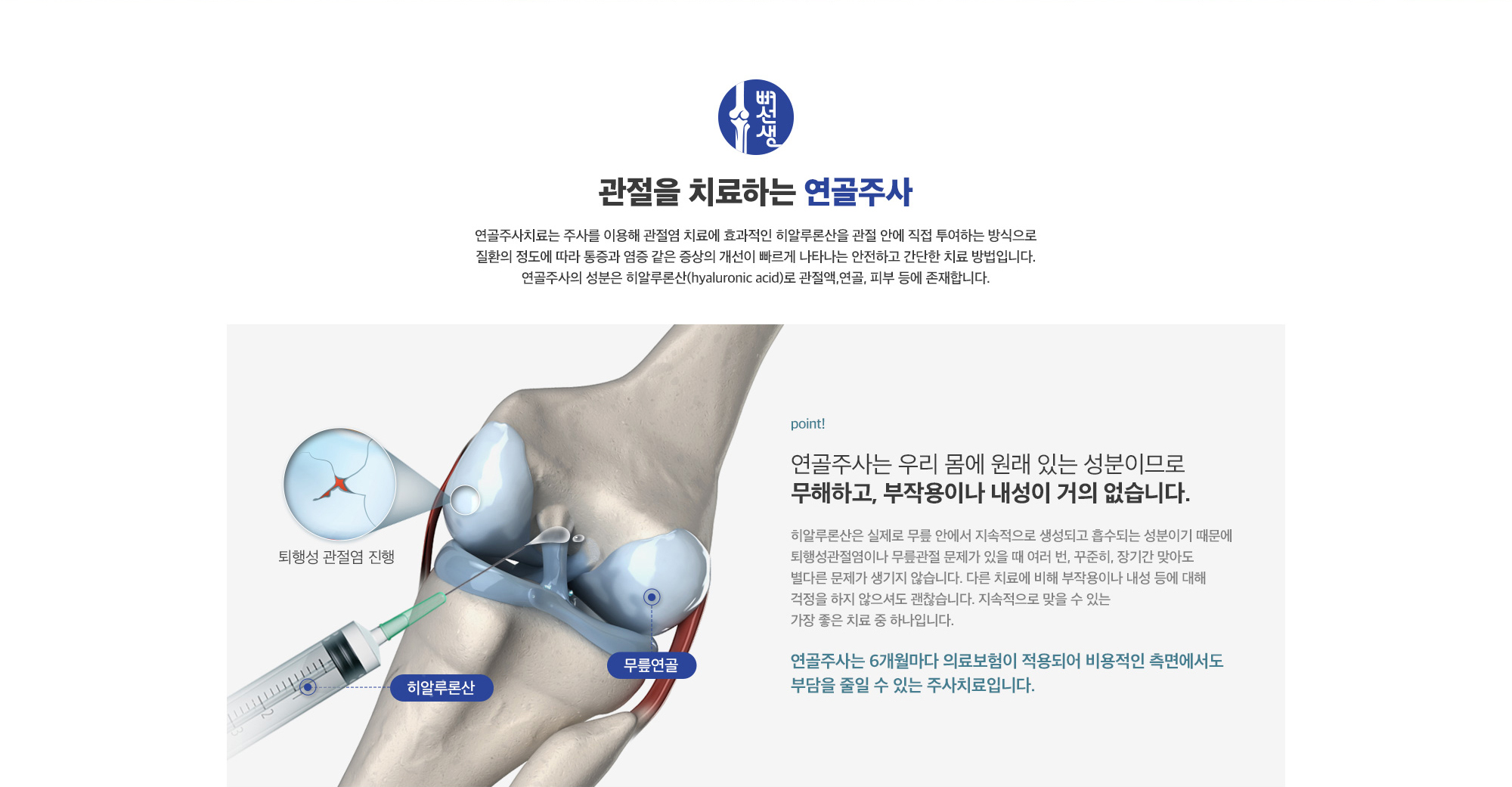 연골주사